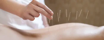 Qué es la acupuntura