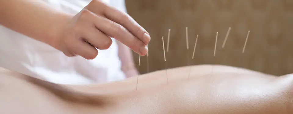 acupuntura en la zenia alicante Acupuncture